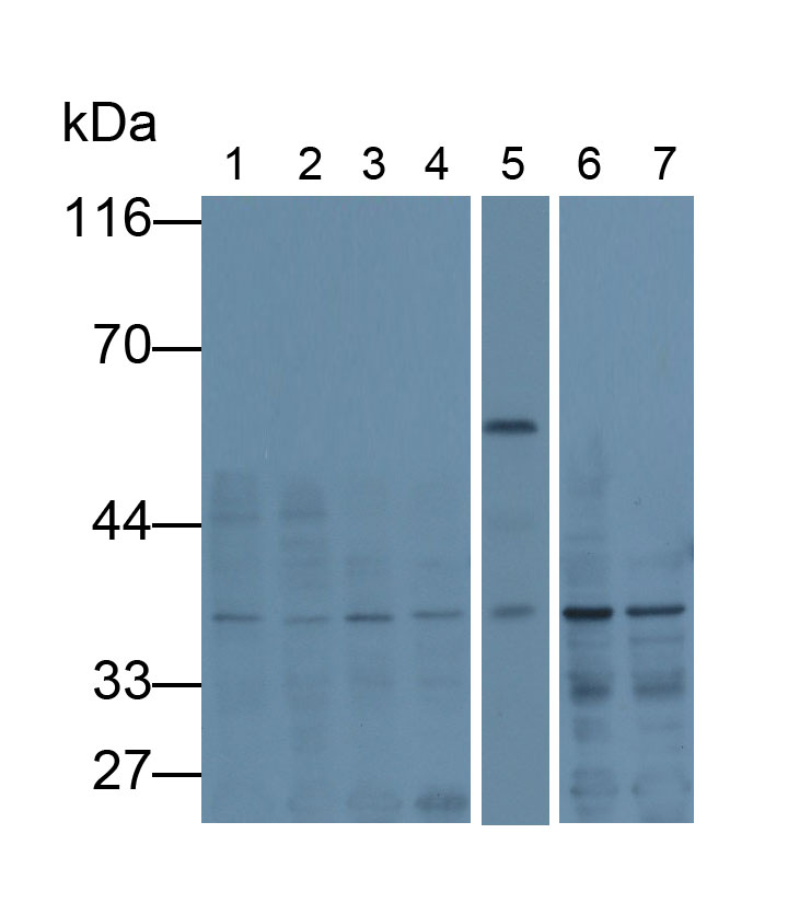 Monoclonal Antibody to Glyceraldehyde-3-Phosphate Dehydrogenase (GAPDH)