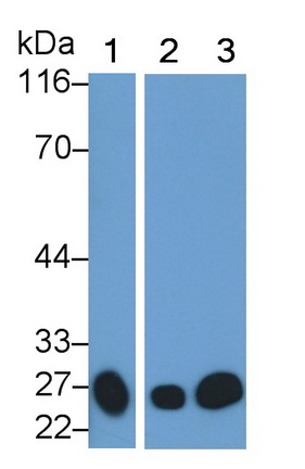 Monoclonal Antibody to Cathepsin S (CTSS)