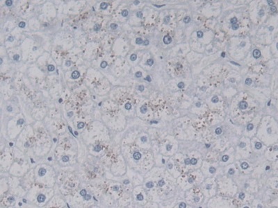 Monoclonal Antibody to Leucine Rich Alpha-2-Glycoprotein 1 (LRG1)