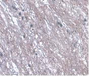 Monoclonal Antibody to Leucine Rich Alpha-2-Glycoprotein 1 (LRG1)