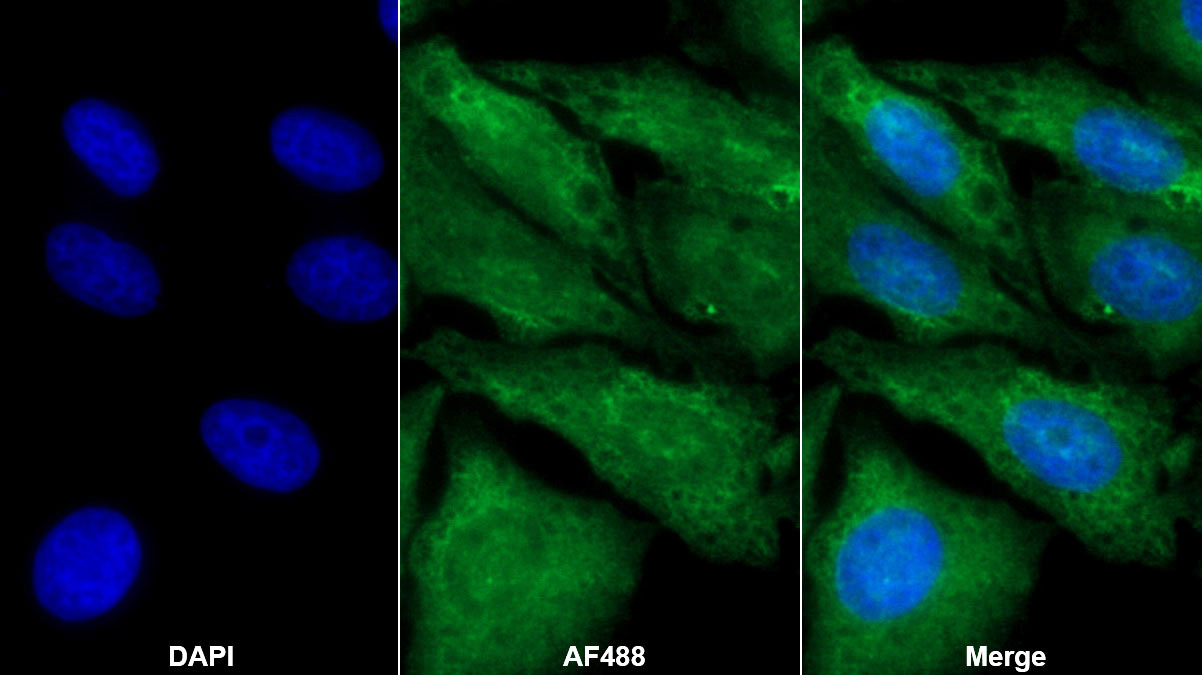 Monoclonal Antibody to Transforming Growth Factor Beta 3 (TGFb3)