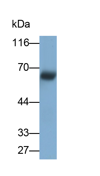 Monoclonal Antibody to Monoamine Oxidase A (MAOA)