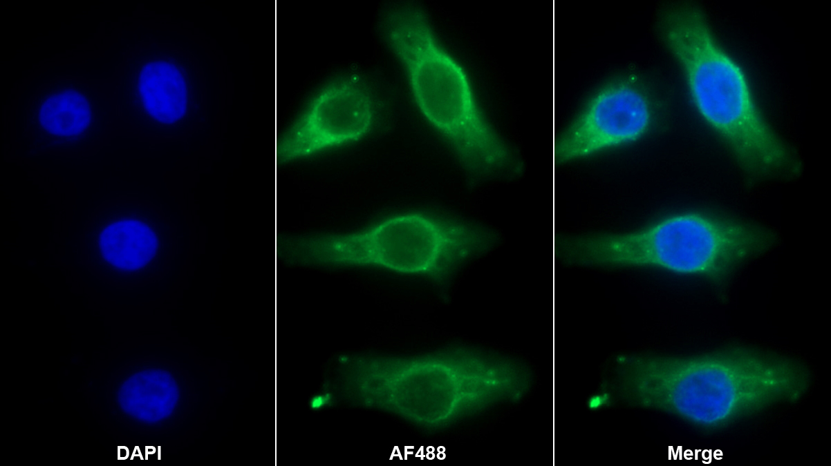 Monoclonal Antibody to Interleukin 17F (IL17F)