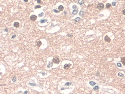 Monoclonal Antibody to Cluster Of Differentiation 34 (CD34)