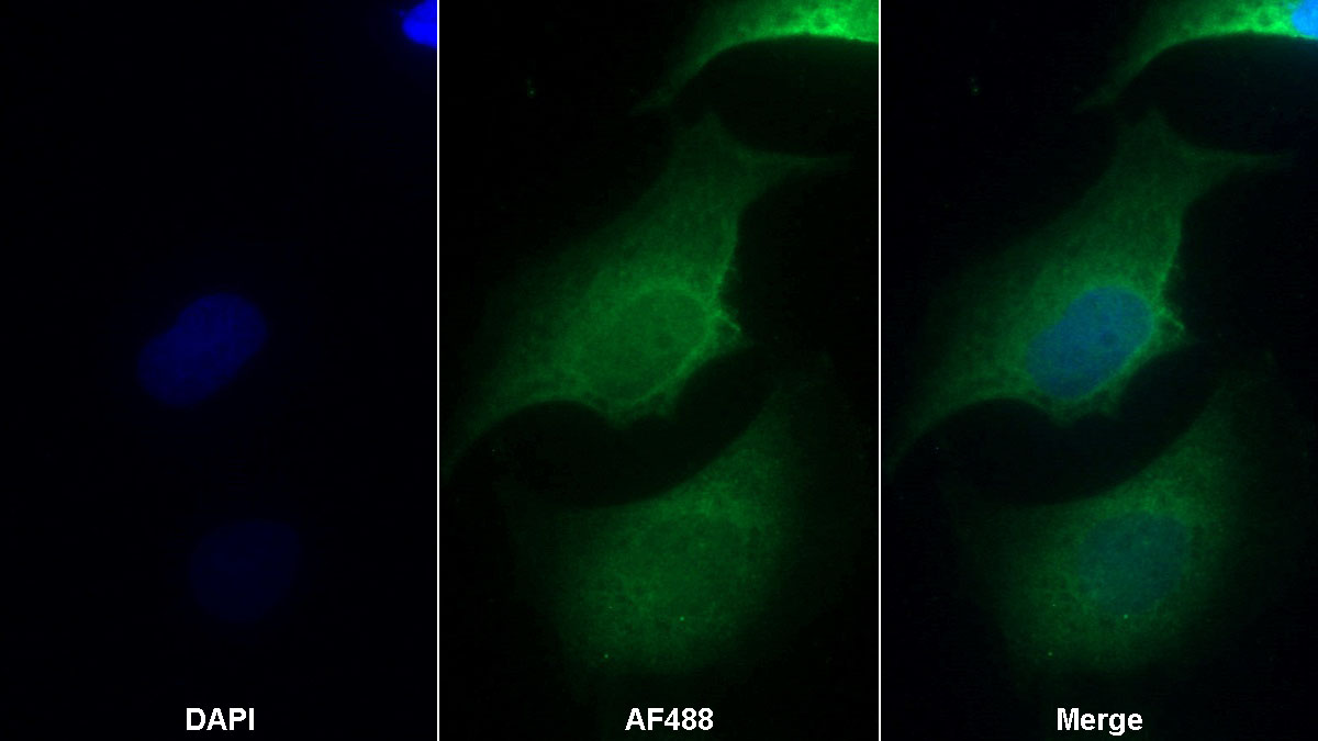 Monoclonal Antibody to Cluster Of Differentiation 34 (CD34)