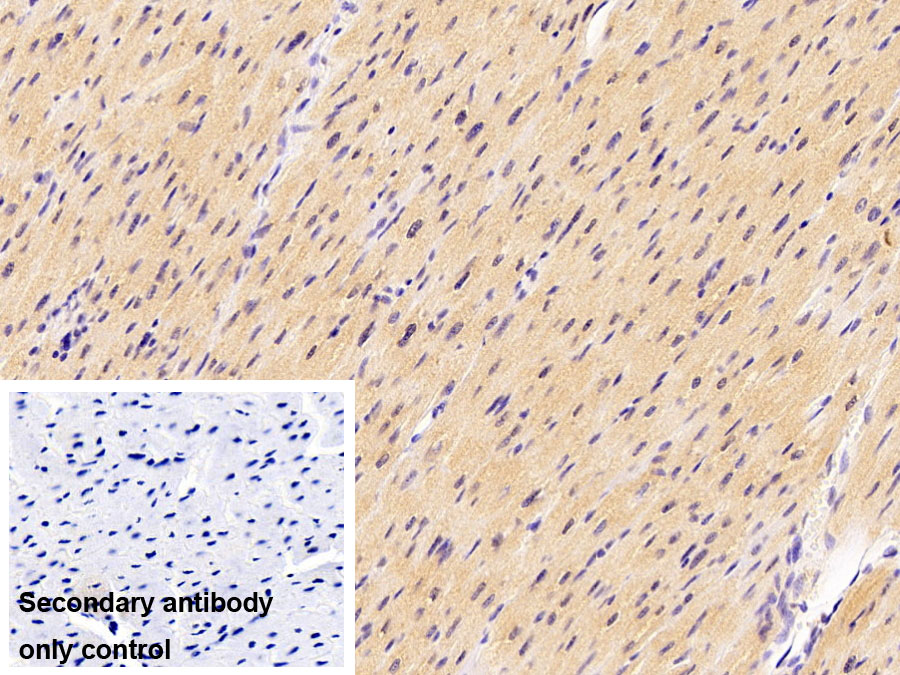 Monoclonal Antibody to Superoxide Dismutase 1 (SOD1)