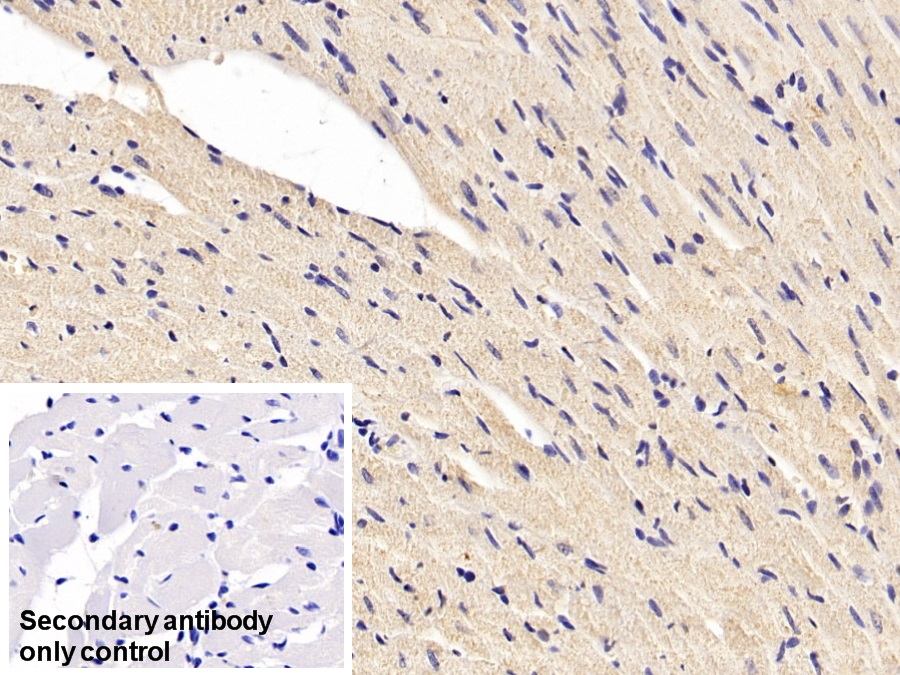 Monoclonal Antibody to Superoxide Dismutase 1 (SOD1)