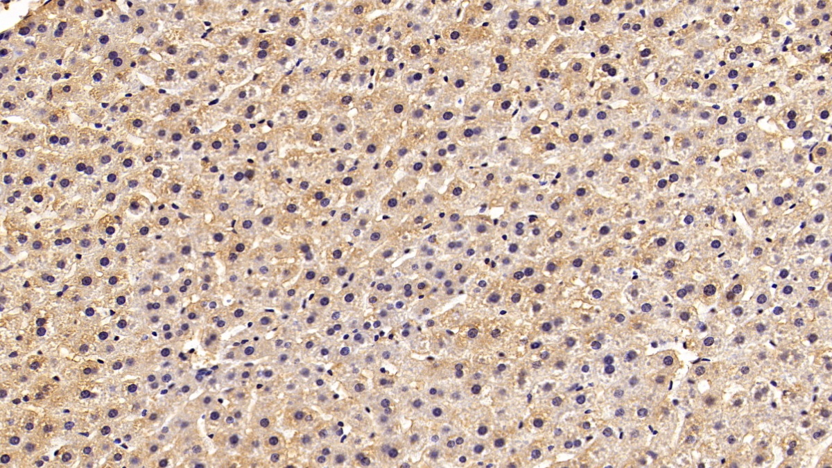 Monoclonal Antibody to Superoxide Dismutase 1 (SOD1)