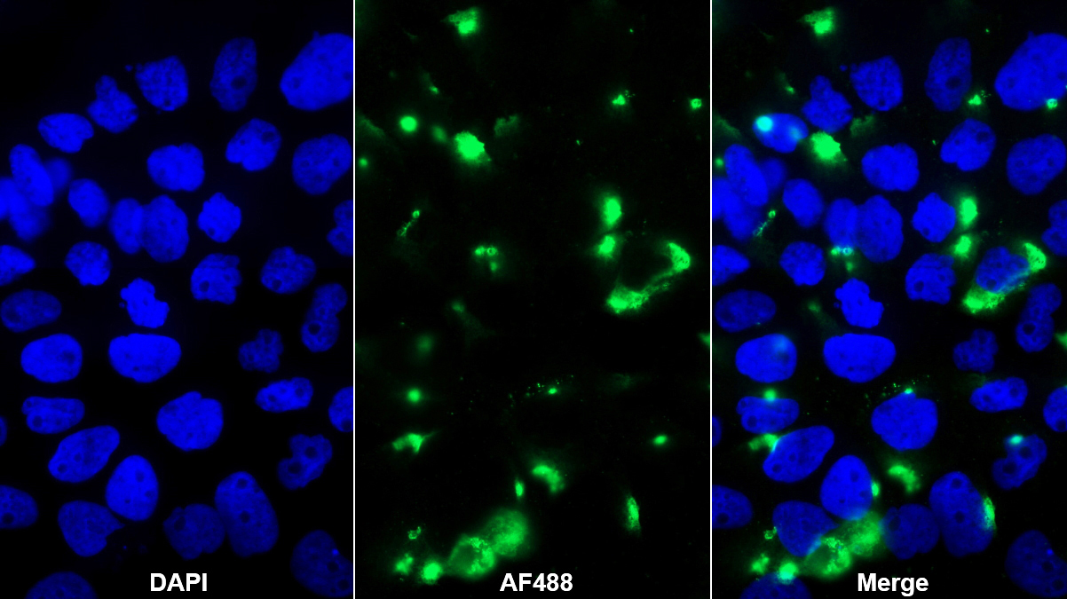 Monoclonal Antibody to Syndecan 1 (SDC1)