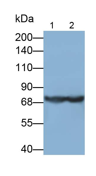 Monoclonal Antibody to Complement Component 5 (C5)