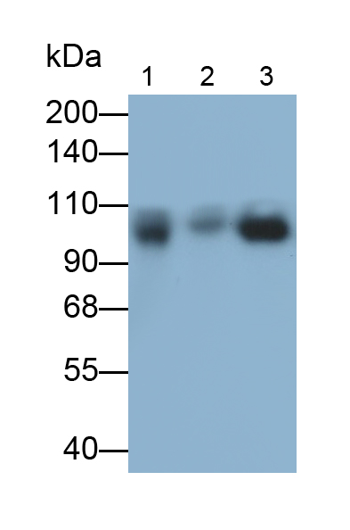 Monoclonal Antibody to Complement Component 5 (C5)