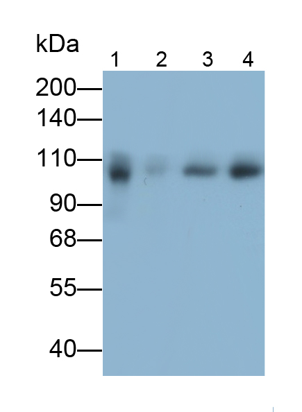 Monoclonal Antibody to Complement Component 5 (C5)