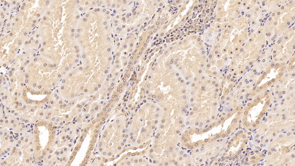 Monoclonal Antibody to Tenascin C (TNC)