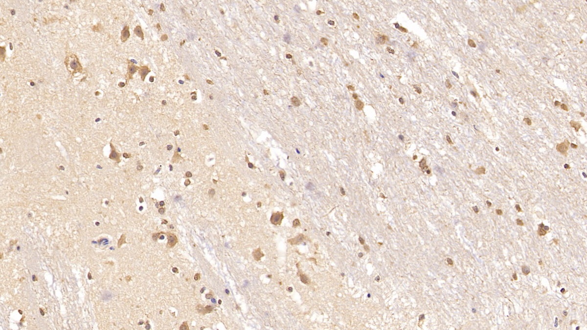 Monoclonal Antibody to Tenascin C (TNC)