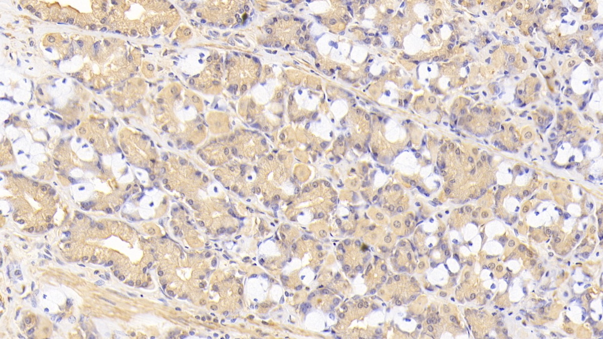 Monoclonal Antibody to Tenascin C (TNC)