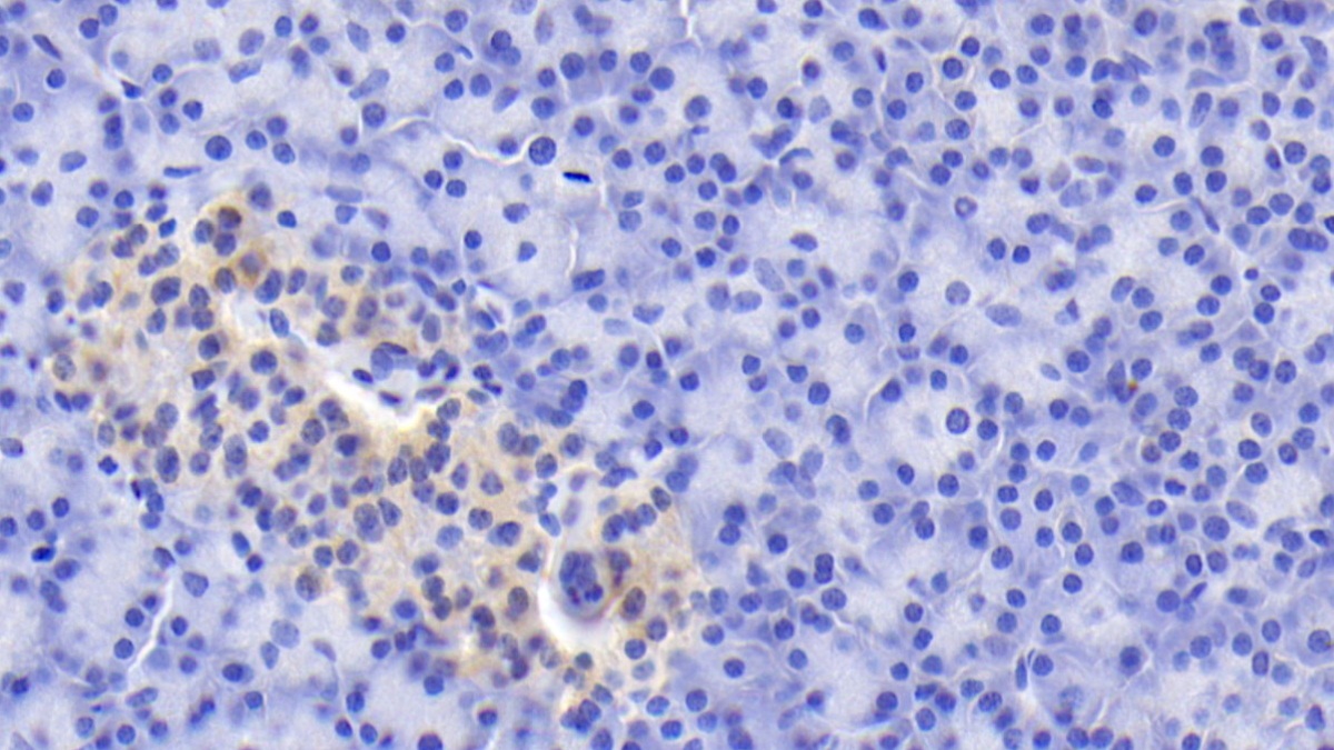 Monoclonal Antibody to Tenascin C (TNC)