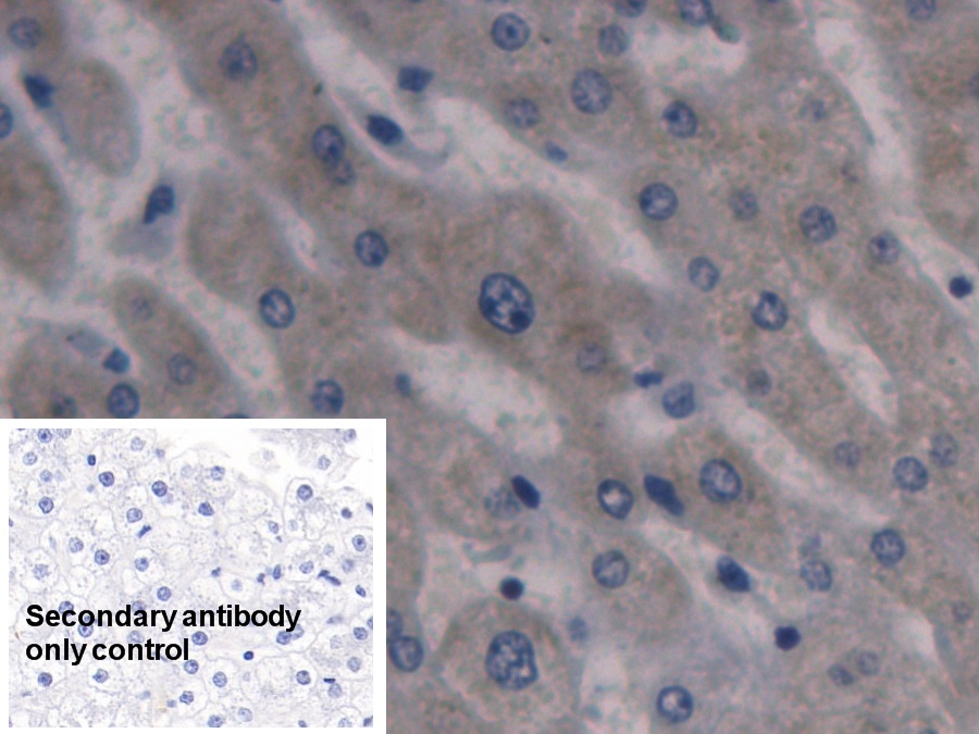 Monoclonal Antibody to Hepcidin (Hepc)