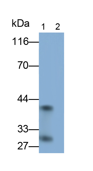 Monoclonal Antibody to Interleukin 33 (IL33)