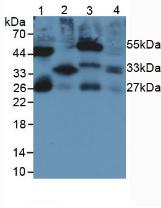 Monoclonal Antibody to Interleukin 33 (IL33)