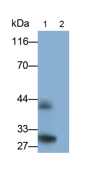 Monoclonal Antibody to Interleukin 33 (IL33)