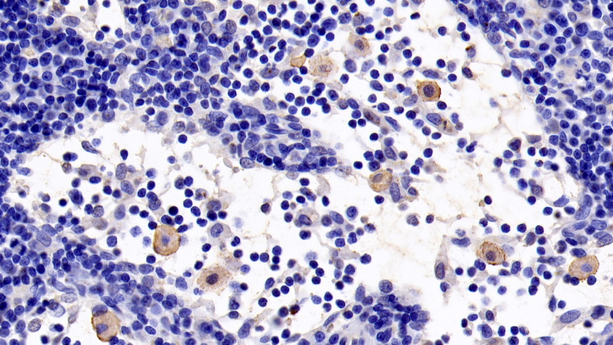 Monoclonal Antibody to Toll Like Receptor 5 (TLR5)