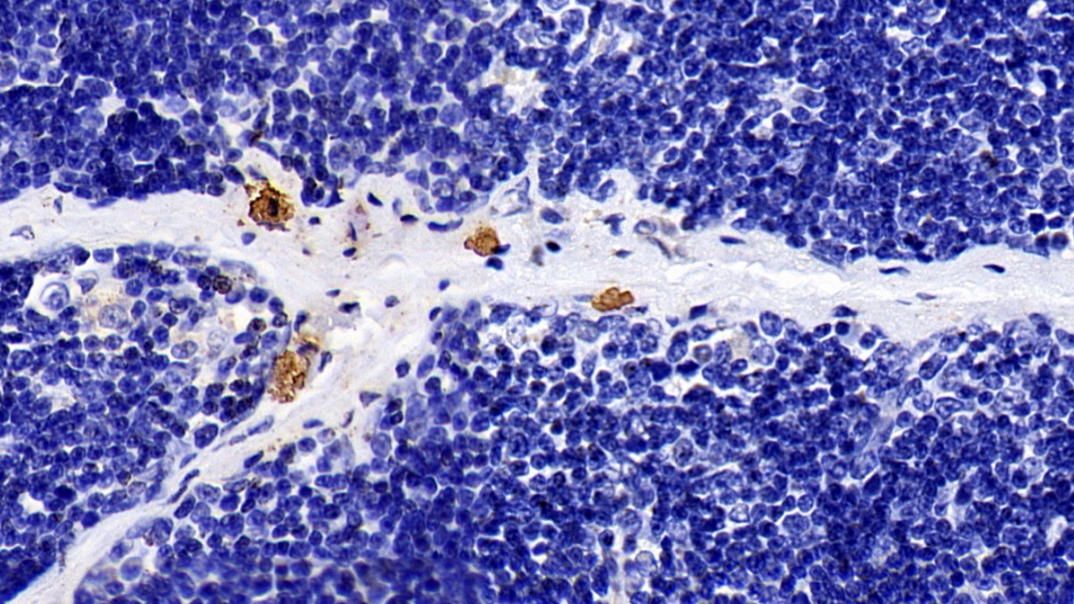 Monoclonal Antibody to Toll Like Receptor 5 (TLR5)