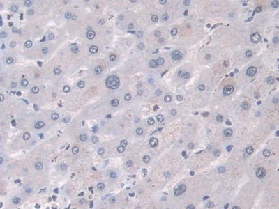 Monoclonal Antibody to Hemojuvelin (HJV)