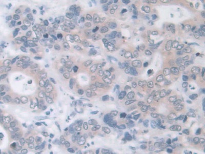 Monoclonal Antibody to Hemojuvelin (HJV)