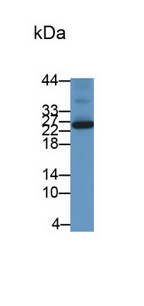 Monoclonal Antibody to Hemojuvelin (HJV)