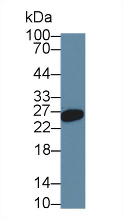 Monoclonal Antibody to Hemojuvelin (HJV)