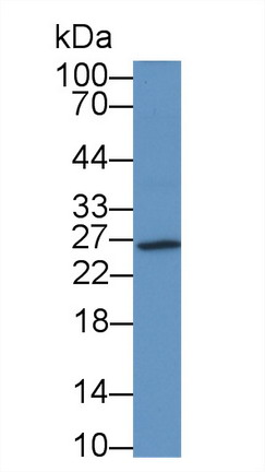 Monoclonal Antibody to Hemojuvelin (HJV)