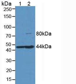 Monoclonal Antibody to Hemojuvelin (HJV)