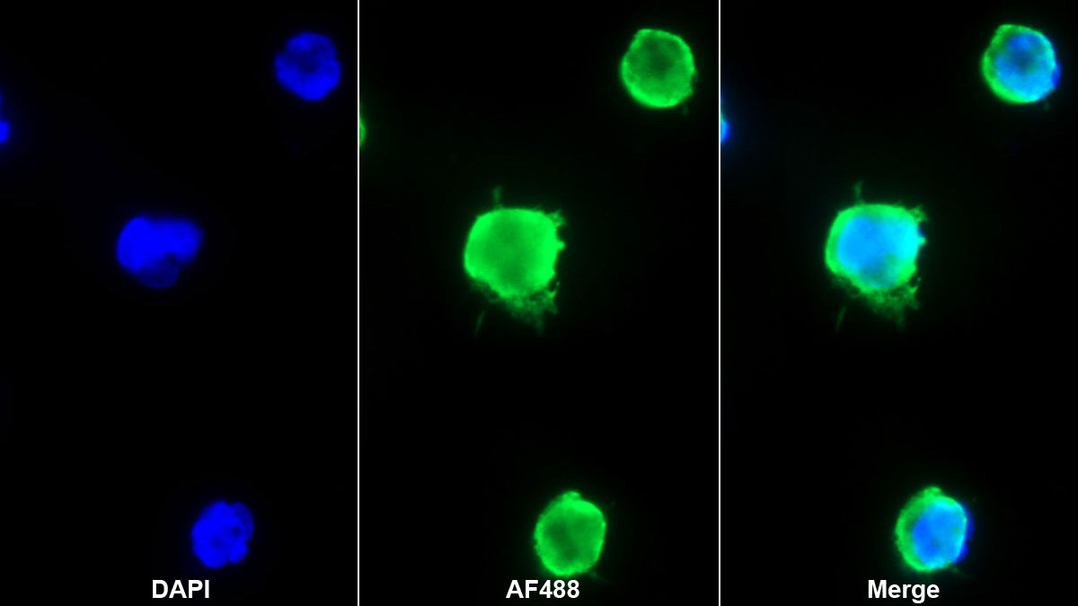 Monoclonal Antibody to Hemojuvelin (HJV)