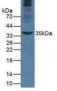 Monoclonal Antibody to Apolipoprotein A5 (APOA5)