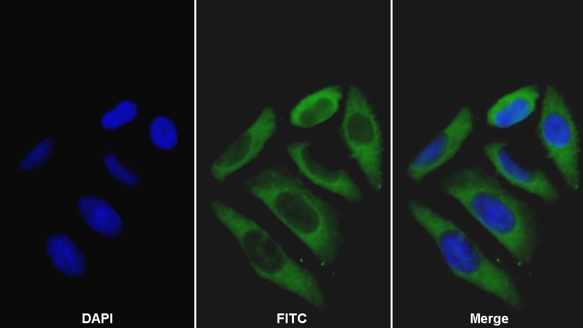 Monoclonal Antibody to Haptoglobin Related Protein (HPR)