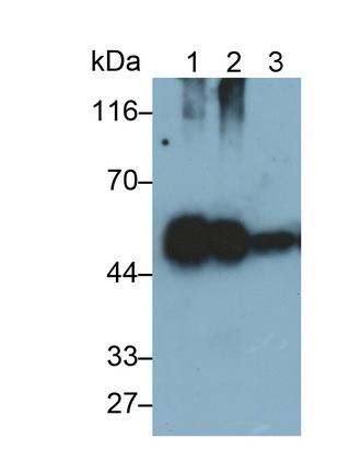 Monoclonal Antibody to Haptoglobin Related Protein (HPR)