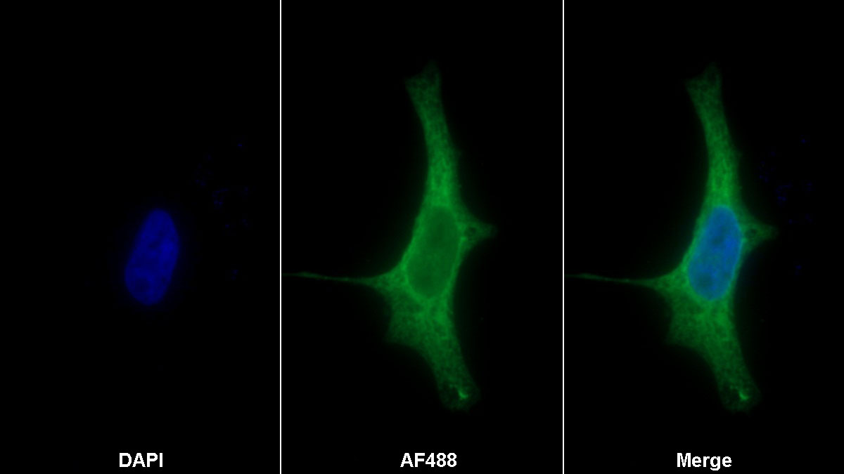 Monoclonal Antibody to Apolipoprotein B (APOB)