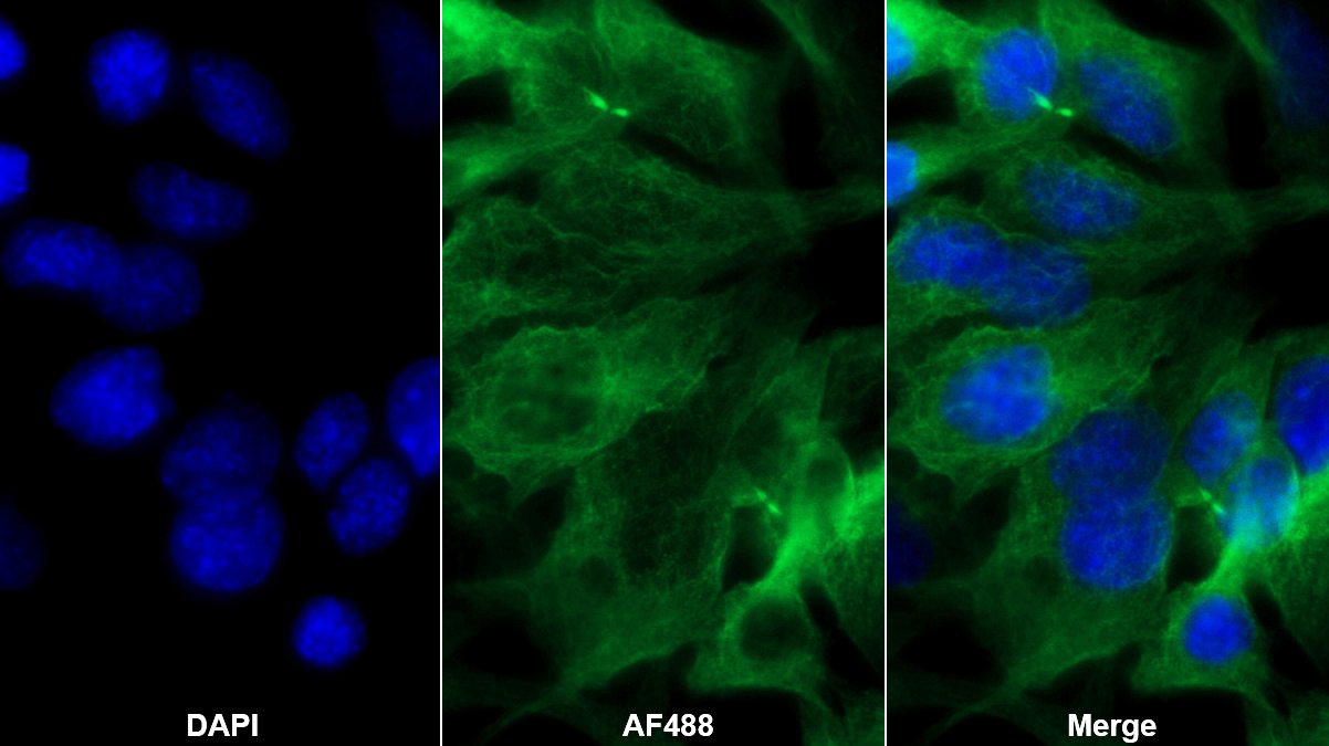 Monoclonal Antibody to Apolipoprotein B (APOB)