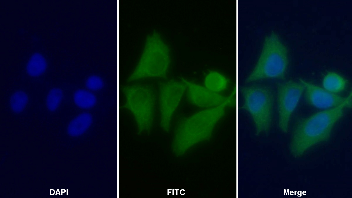 Monoclonal Antibody to Apolipoprotein B (APOB)