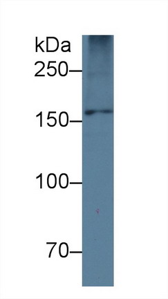 Monoclonal Antibody to Apolipoprotein B (APOB)