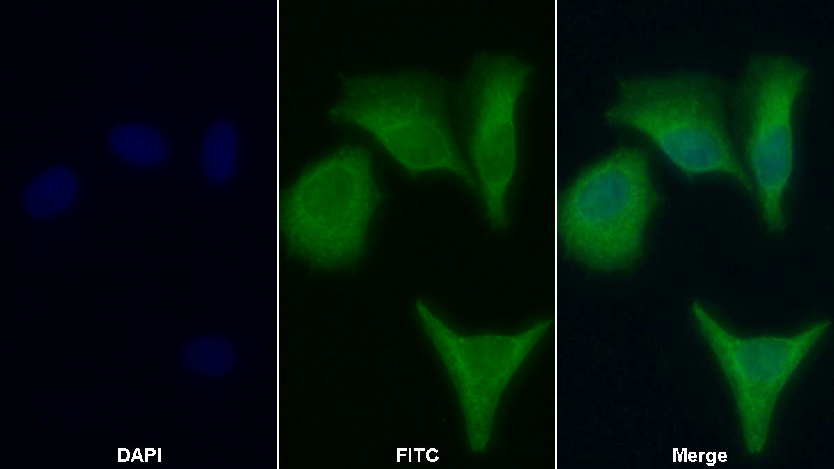 Monoclonal Antibody to Apolipoprotein B (APOB)