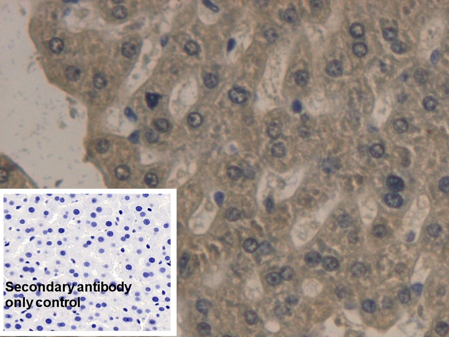 Monoclonal Antibody to Apolipoprotein B (APOB)