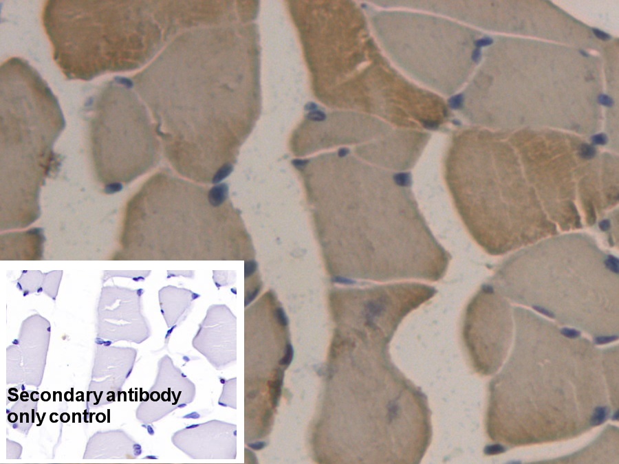 Monoclonal Antibody to Apolipoprotein B (APOB)