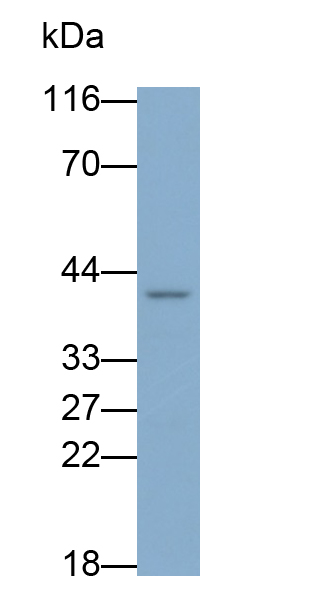 Monoclonal Antibody to Interleukin 8 Receptor Beta (IL8Rb)