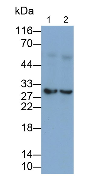 Monoclonal Antibody to Interleukin 35 (IL35)