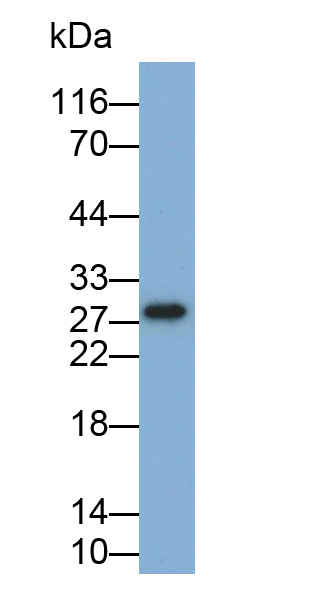 Monoclonal Antibody to Interleukin 35 (IL35)