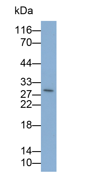 Monoclonal Antibody to Interleukin 35 (IL35)