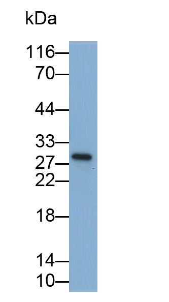 Monoclonal Antibody to Interleukin 35 (IL35)