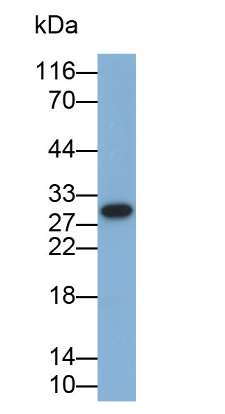 Monoclonal Antibody to Interleukin 35 (IL35)