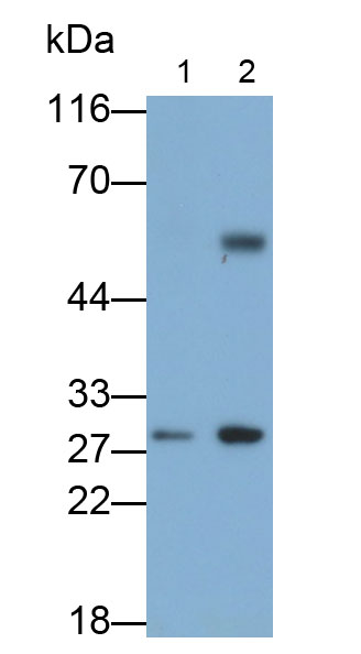 Monoclonal Antibody to Interleukin 35 (IL35)